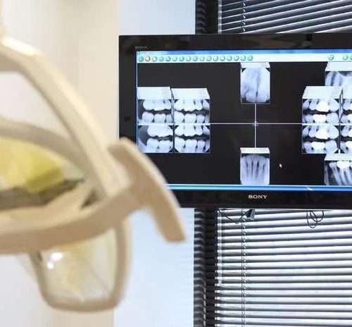 Dentist Greenway Houston - Why 10